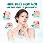 TIGHTAN II CỦA HIFU – TẬP TRUNG NĂNG LƯỢNG, ĐỊNH HÌNH ĐƯỜNG NÉT